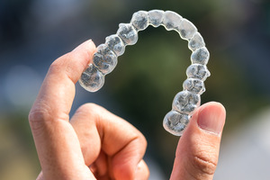 Someone holding an Invisalign treatment