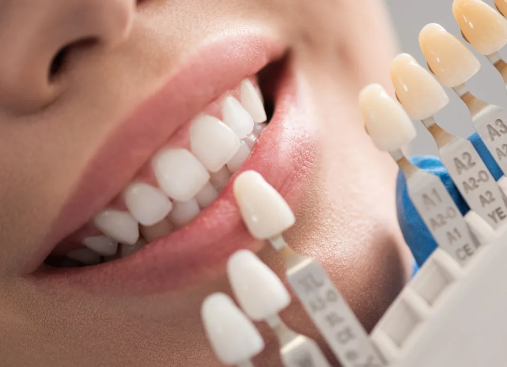 Dentist holding a shade guide in front of a smiling patient