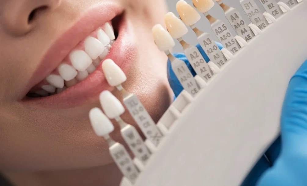 Dentist holding a shade guide to a smiling patient
