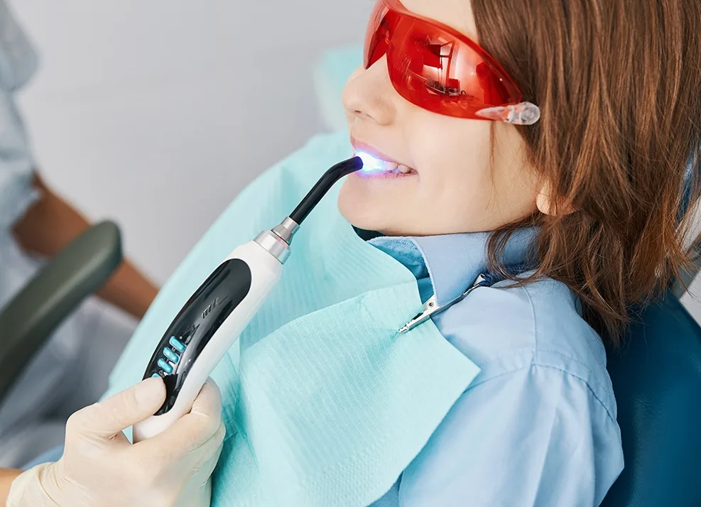 Dentist using a curing light during direct bonding