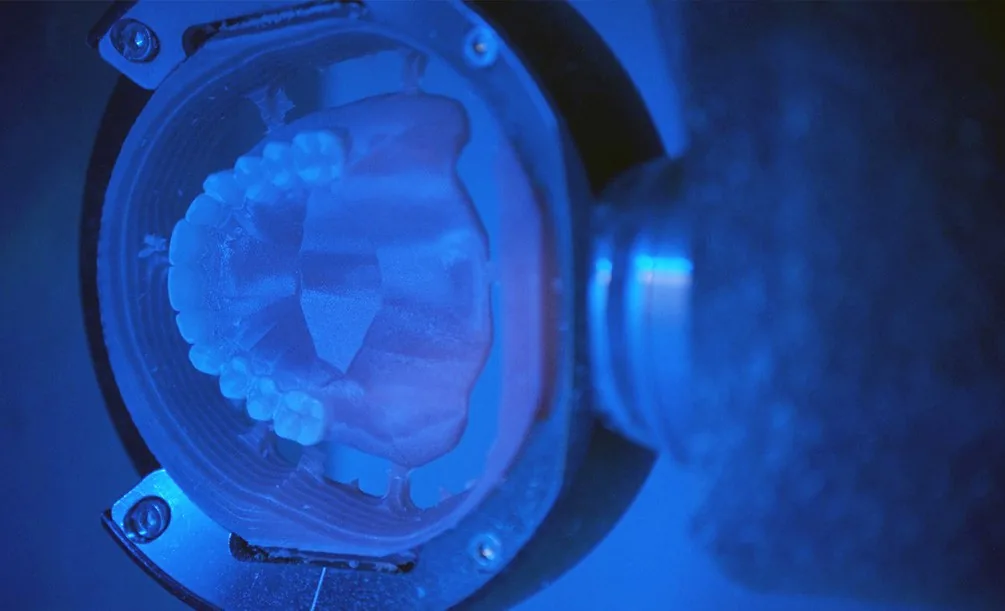 Lower jaw model with dental implants