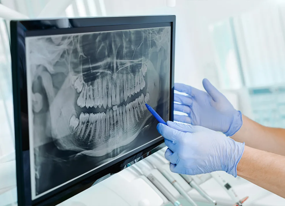 Digital X-rays of teeth displayed on a computer screen
